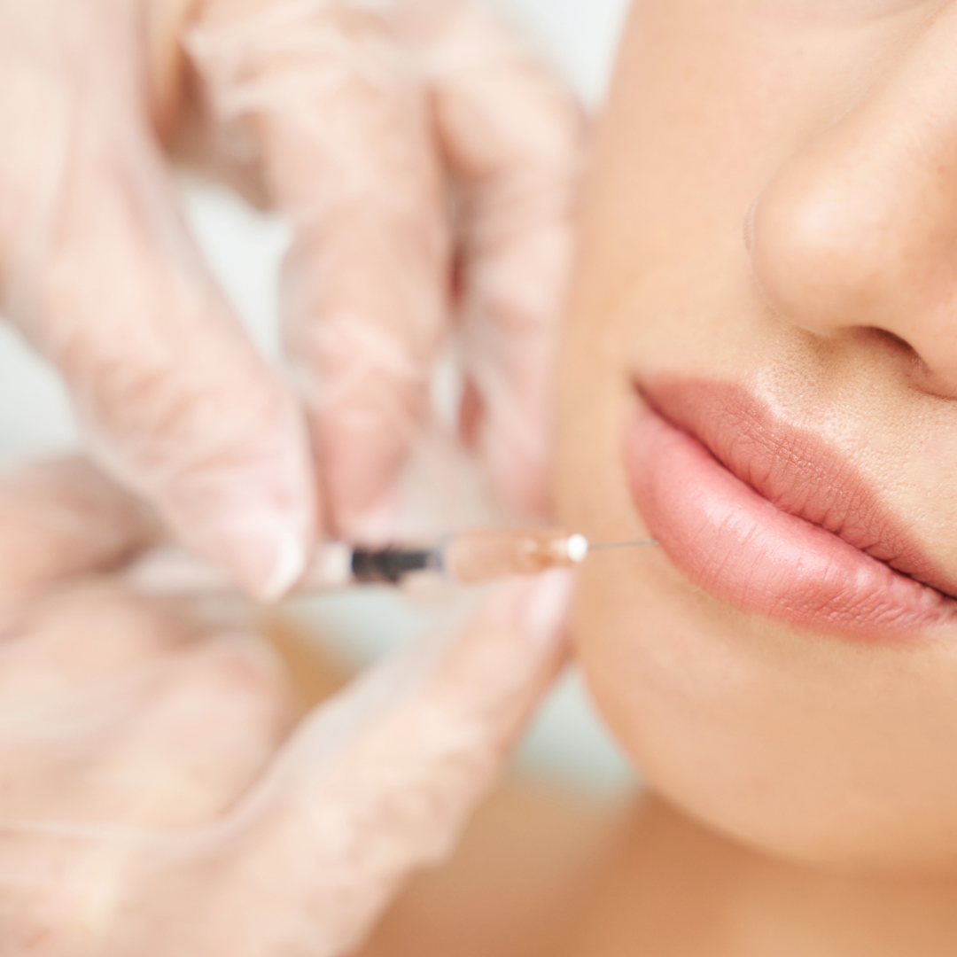 woman having a lip flip treatment at Intrigue Cosmetic Clinic