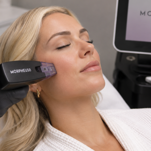 Woman having a Morpheus8 session - Intrigue Cosmetic Clinic explain why they prefer professional microneedling for their client's anti-ageing results.